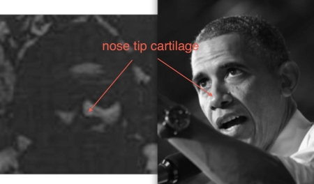 9 - nose tip cartilage - Revolution 1975 to Revolution 2013 - desat